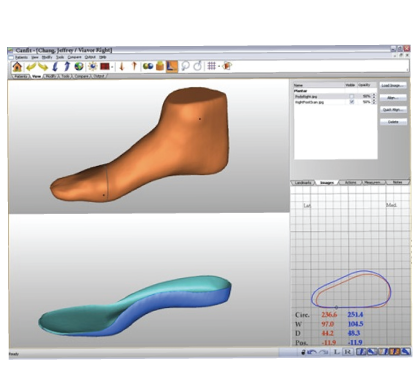 CAD Modeling Of Orthotics